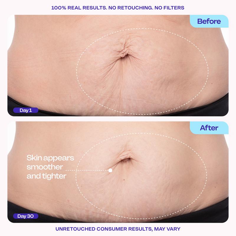 GOPURE Tighten & Smooth Belly Firming Cream