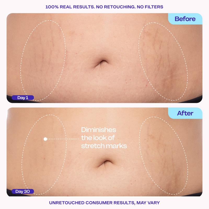 GOPURE Tighten & Smooth Belly Firming Cream
