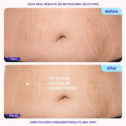 GOPURE Tighten & Smooth Belly Firming Cream