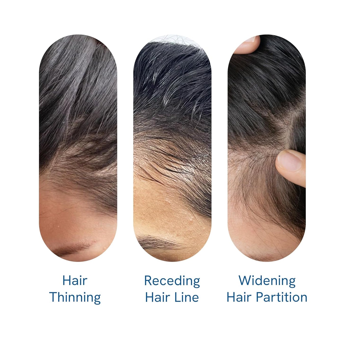 Hair Growth Roll-On Serum