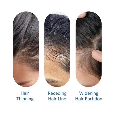 Hair Growth Roll-On Serum